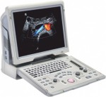 Портативный ультразвуковой диагностический сканер Mindray Z6